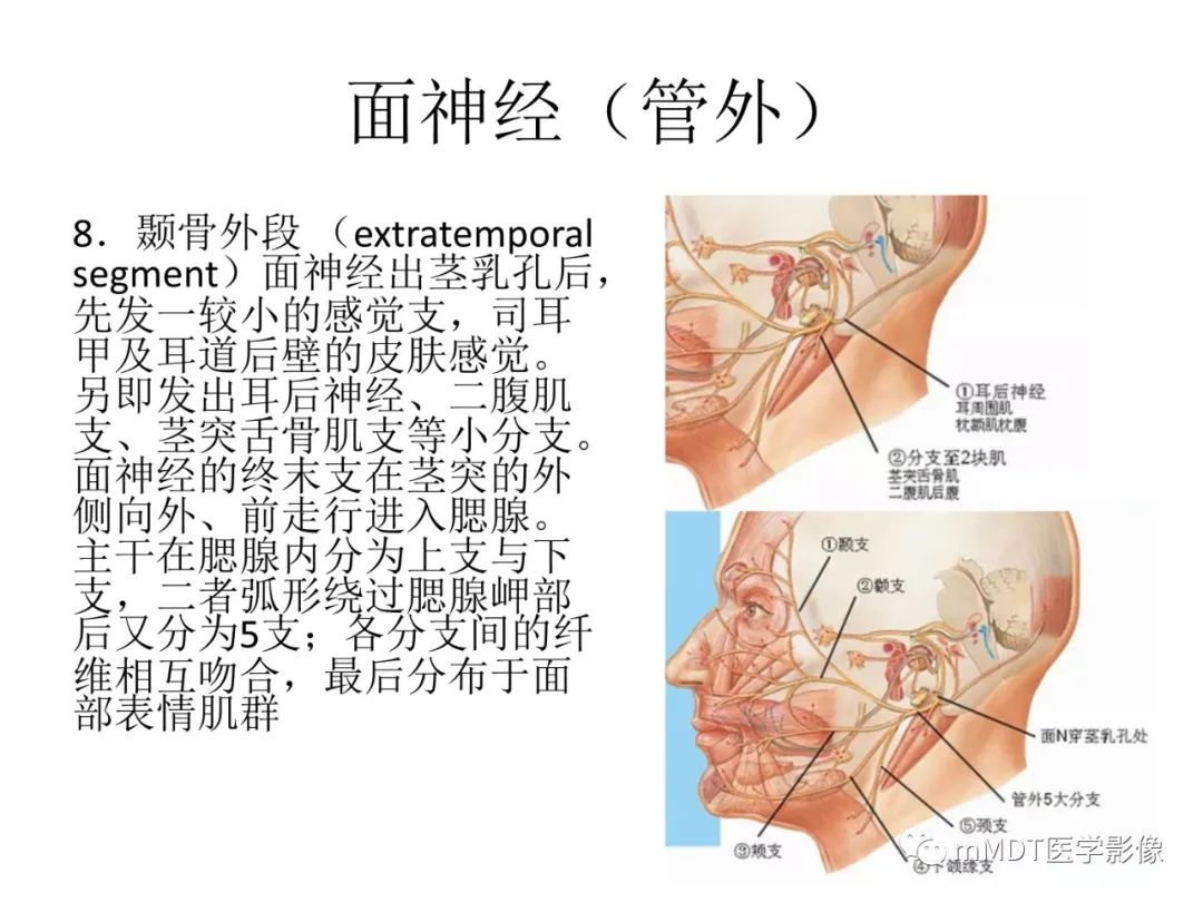 影像PPT - 【PPT】行走在孔道里的面神经-8