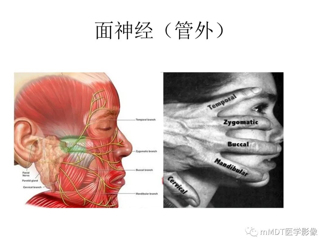影像PPT - 【PPT】行走在孔道里的面神经-9