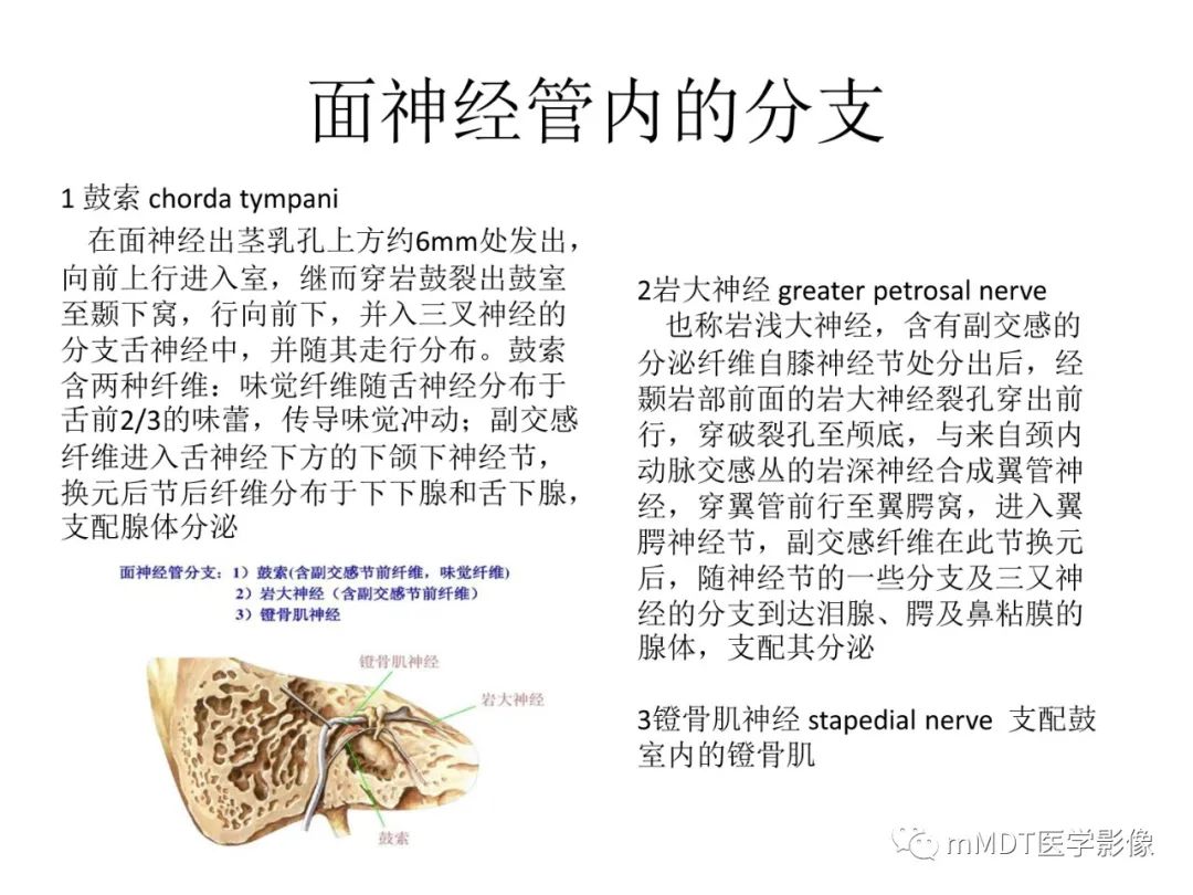 影像PPT - 【PPT】行走在孔道里的面神经-11
