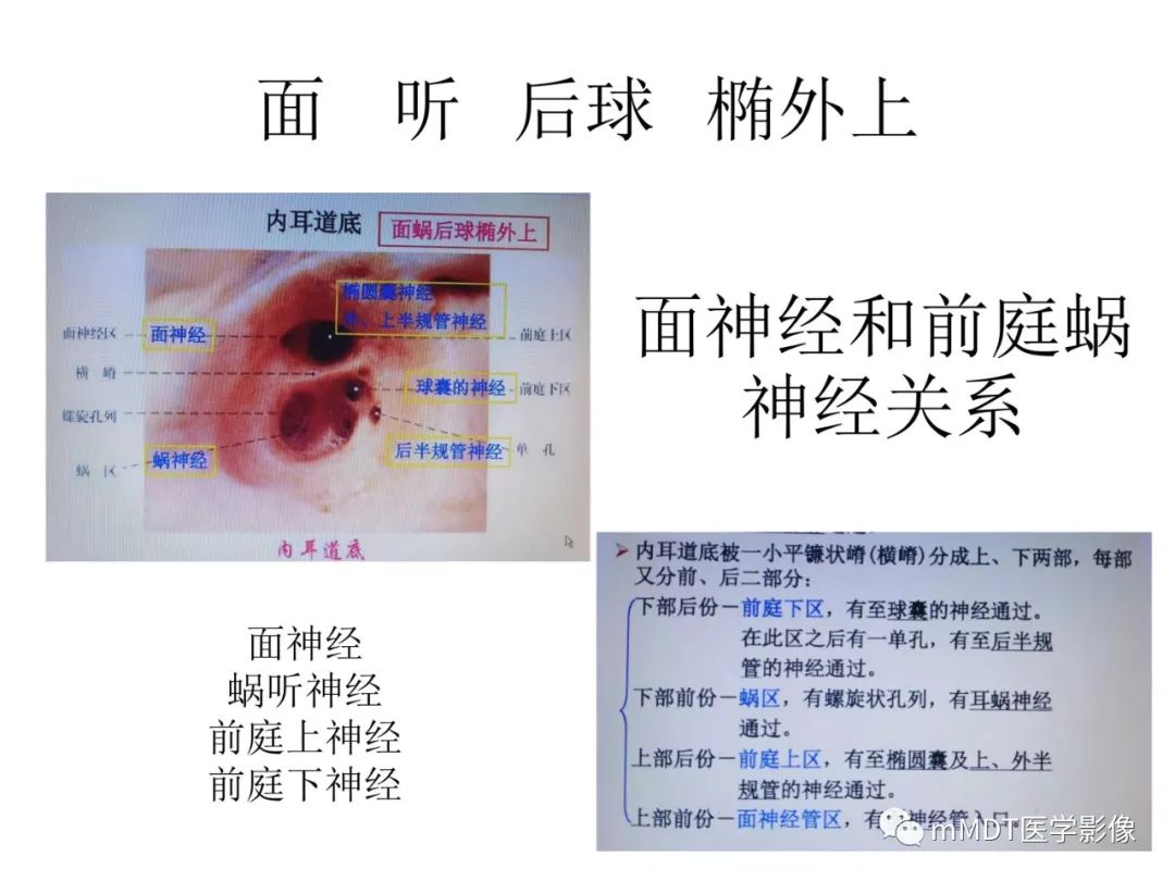影像PPT - 【PPT】行走在孔道里的面神经-16