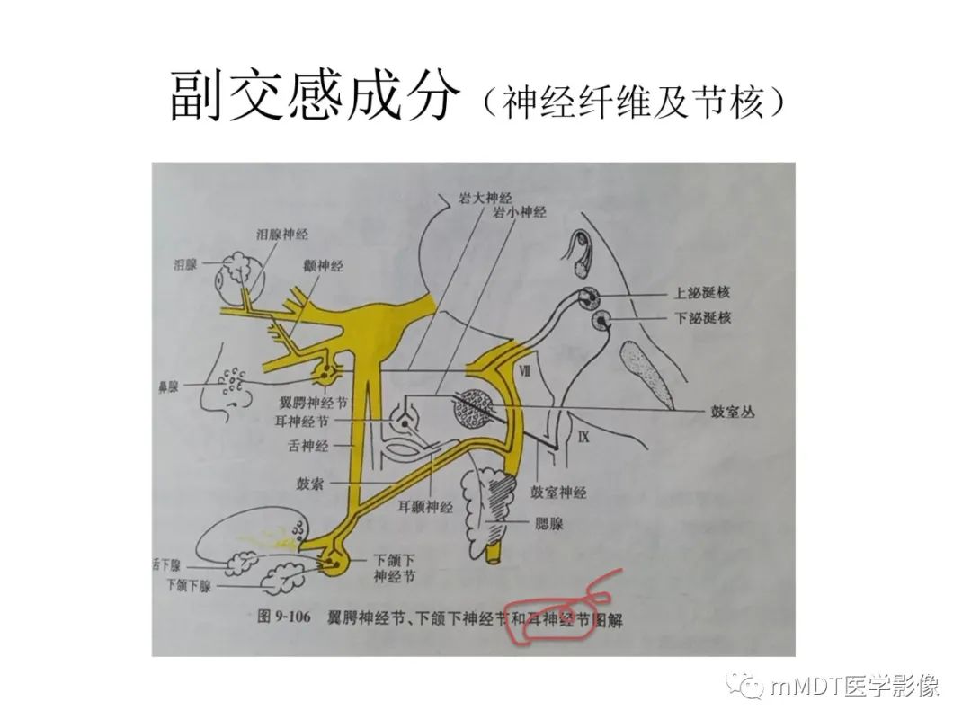 影像PPT - 【PPT】行走在孔道里的面神经-57