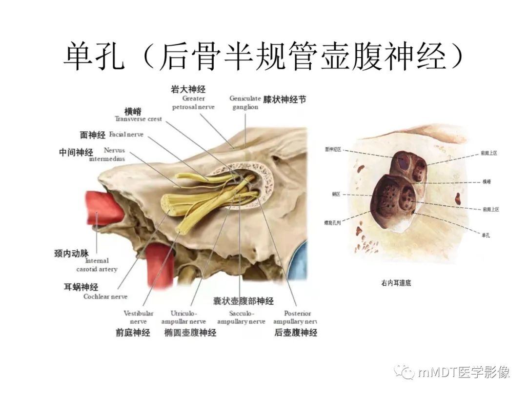 影像PPT - 【PPT】行走在孔道里的面神经-60