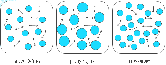 影像PPT - 皮层及皮层下 DWI 高信号: 这 5 类疾病不可忽视-9 影像PPT - 皮层及皮层下 DWI 高信号: 这 5 类疾病不可忽视-9