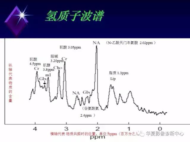 影像PPT - 【PPT】中枢神经系统MRS-2
