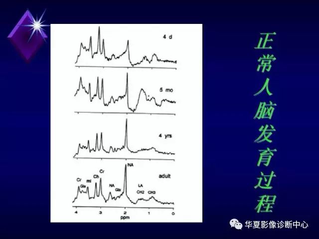 影像PPT - 【PPT】中枢神经系统MRS-13