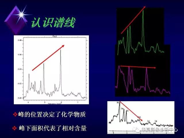 影像PPT - 【PPT】中枢神经系统MRS-11