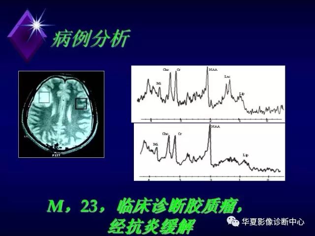 影像PPT - 【PPT】中枢神经系统MRS-21
