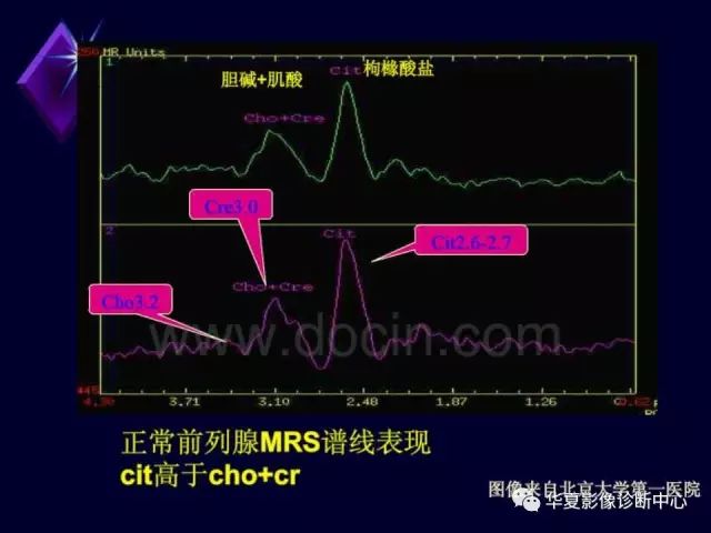 影像PPT - 【PPT】中枢神经系统MRS-44
