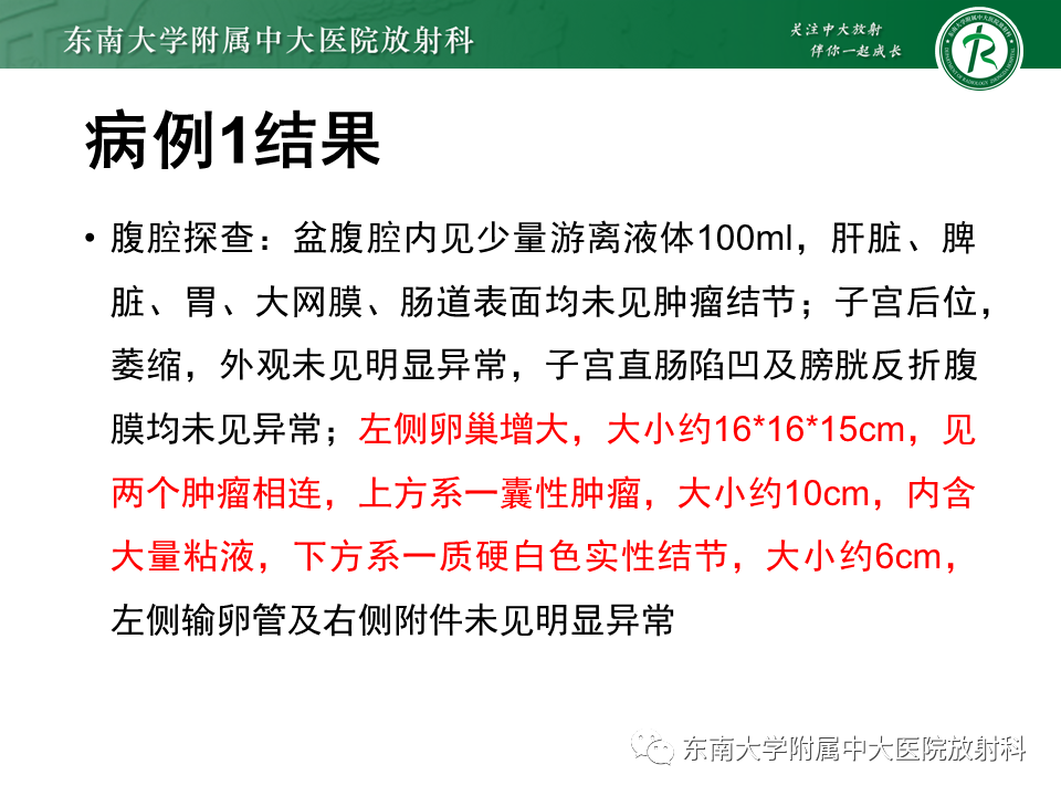 影像PPT - 【PPT】卵巢含纤维成份占位性病变分析-6