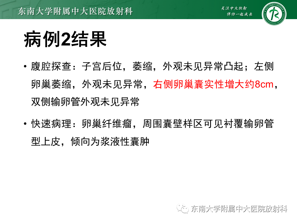影像PPT - 【PPT】卵巢含纤维成份占位性病变分析-8