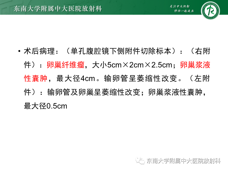 影像PPT - 【PPT】卵巢含纤维成份占位性病变分析-9