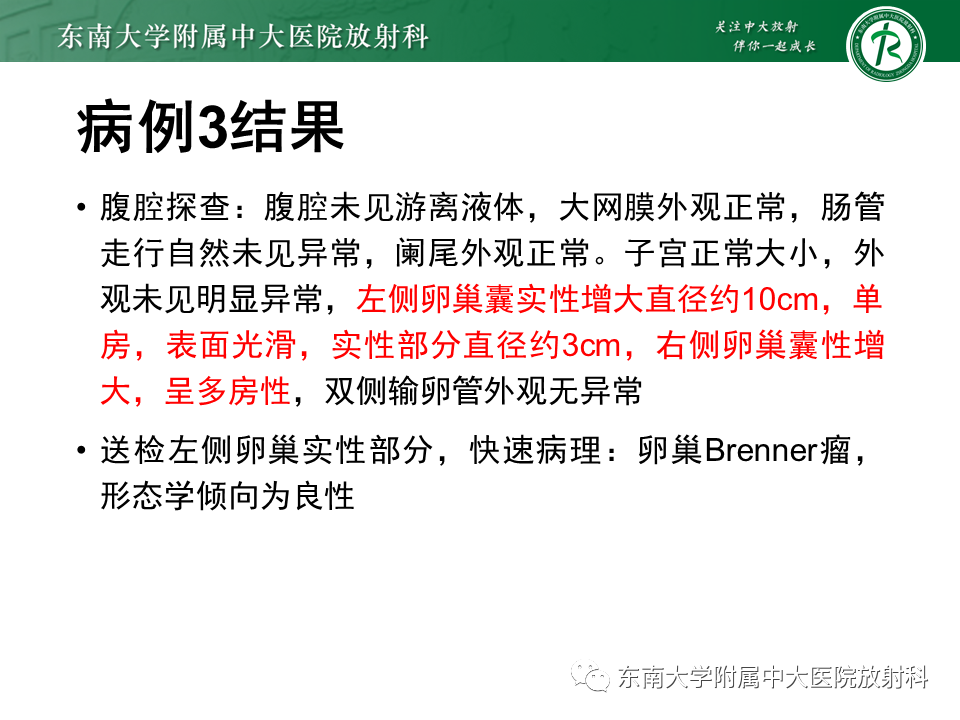 影像PPT - 【PPT】卵巢含纤维成份占位性病变分析-10