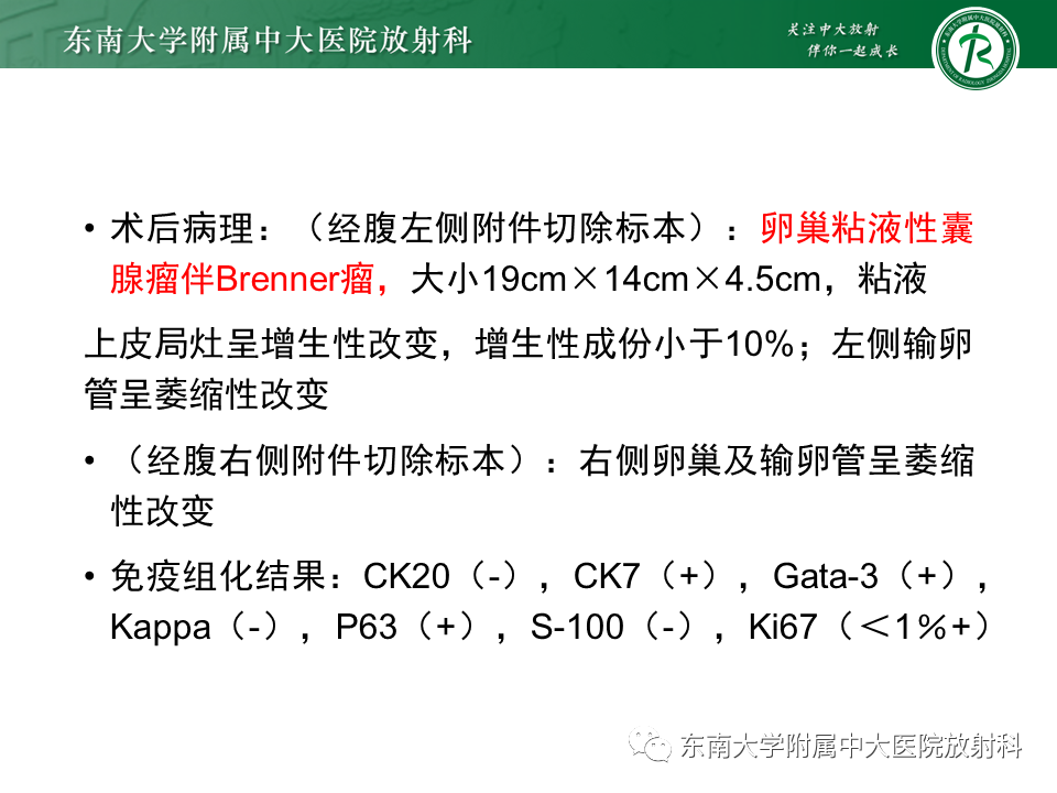 影像PPT - 【PPT】卵巢含纤维成份占位性病变分析-7