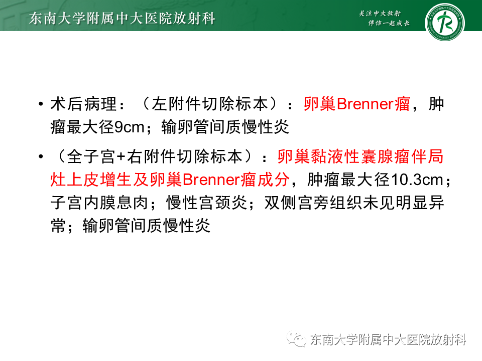 影像PPT - 【PPT】卵巢含纤维成份占位性病变分析-11