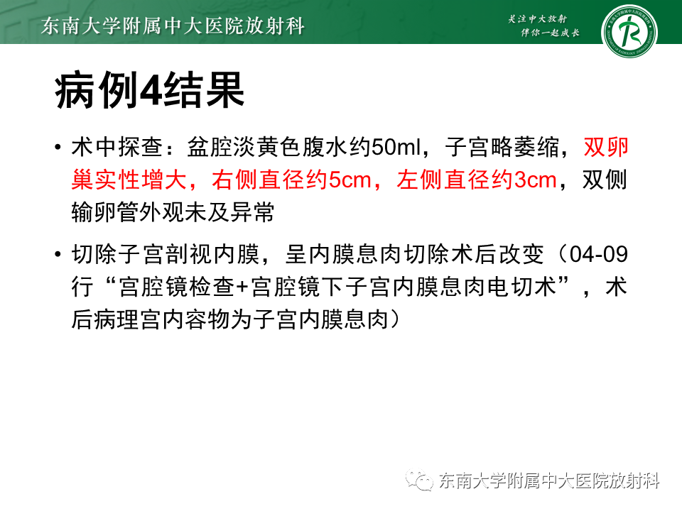 影像PPT - 【PPT】卵巢含纤维成份占位性病变分析-12