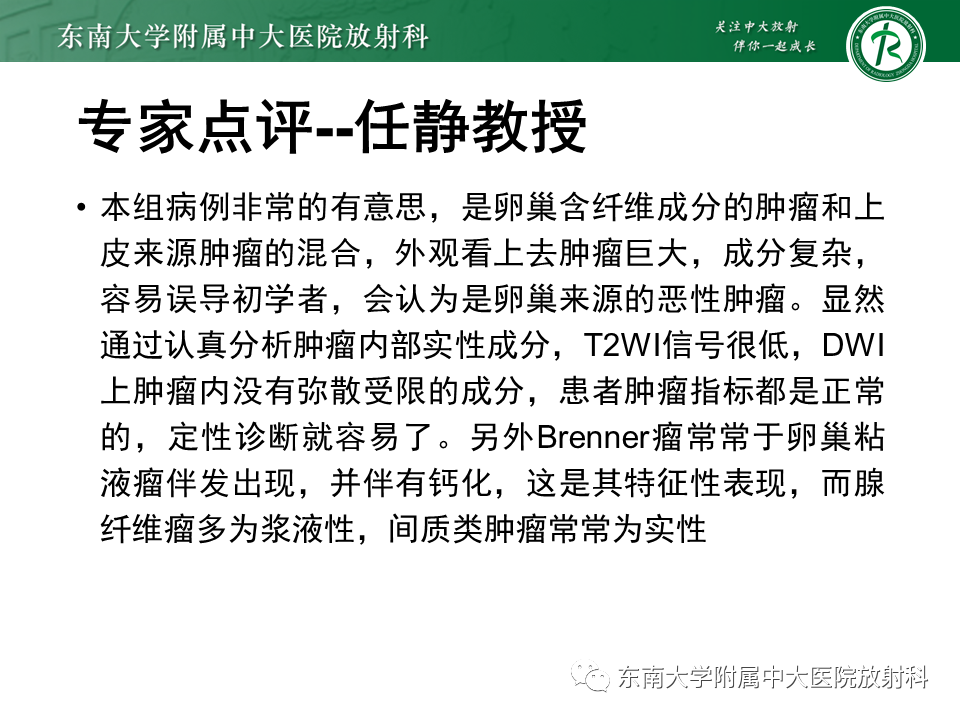 影像PPT - 【PPT】卵巢含纤维成份占位性病变分析-15