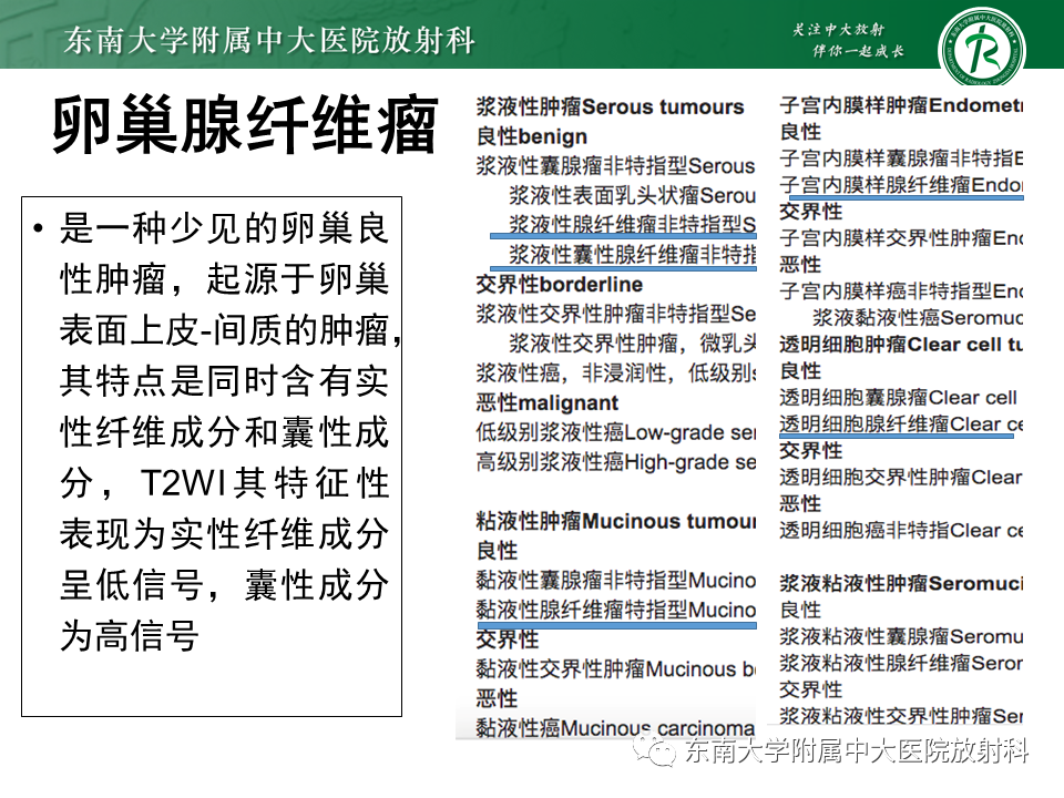 影像PPT - 【PPT】卵巢含纤维成份占位性病变分析-22