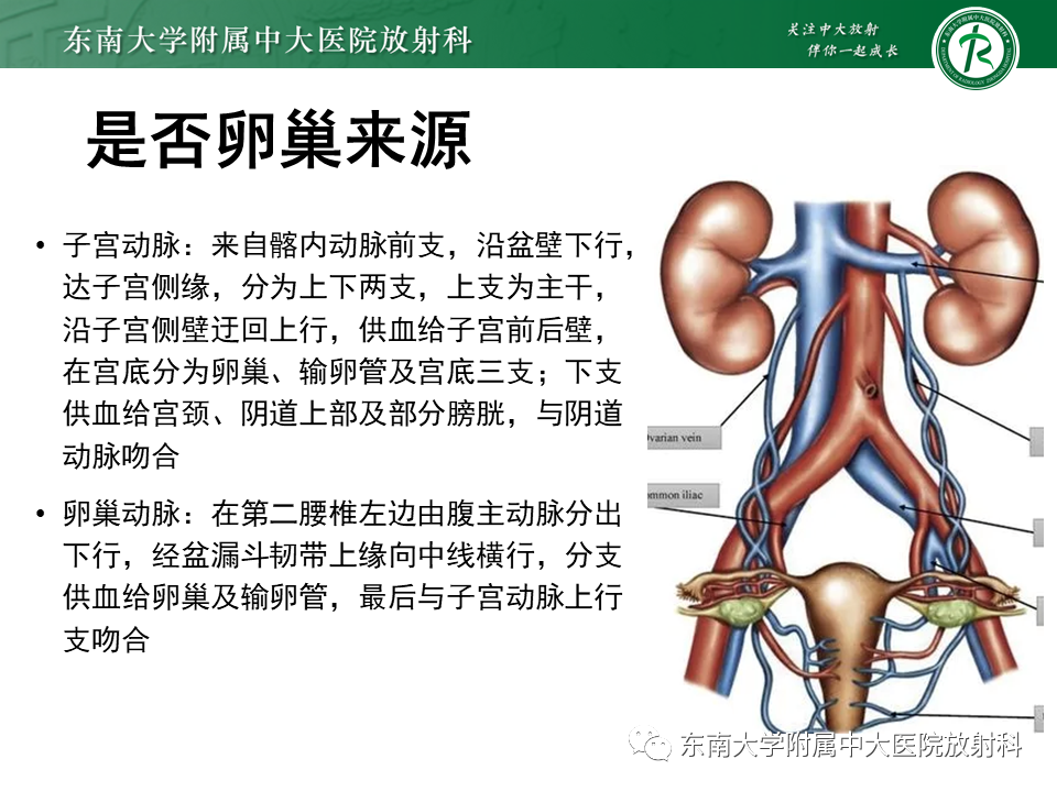影像PPT - 【PPT】卵巢含纤维成份占位性病变分析-29