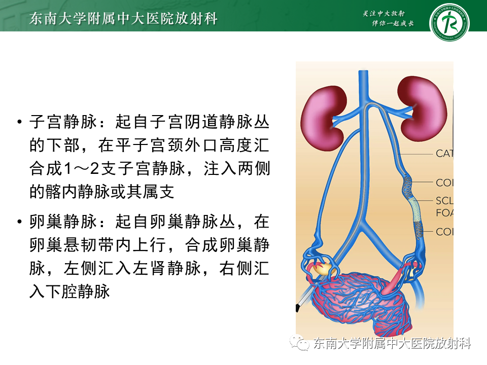 影像PPT - 【PPT】卵巢含纤维成份占位性病变分析-30