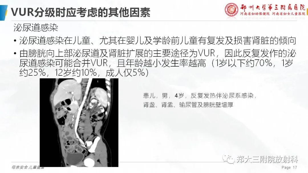 影像PPT - 【PPT】膀胱输尿管返流的影像诊断-17
