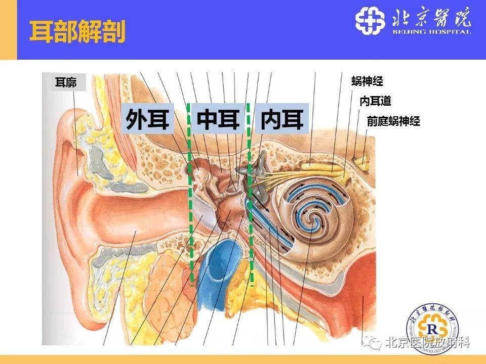 影像PPT - 【PPT】常见内耳畸形及后天获得性病变的影像表现-3