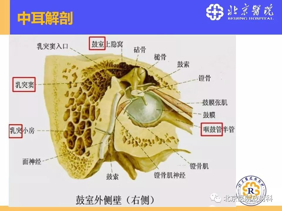 影像PPT - 【PPT】常见内耳畸形及后天获得性病变的影像表现-4