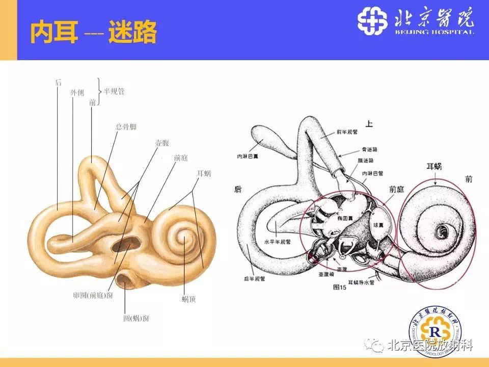 影像PPT - 【PPT】常见内耳畸形及后天获得性病变的影像表现-7