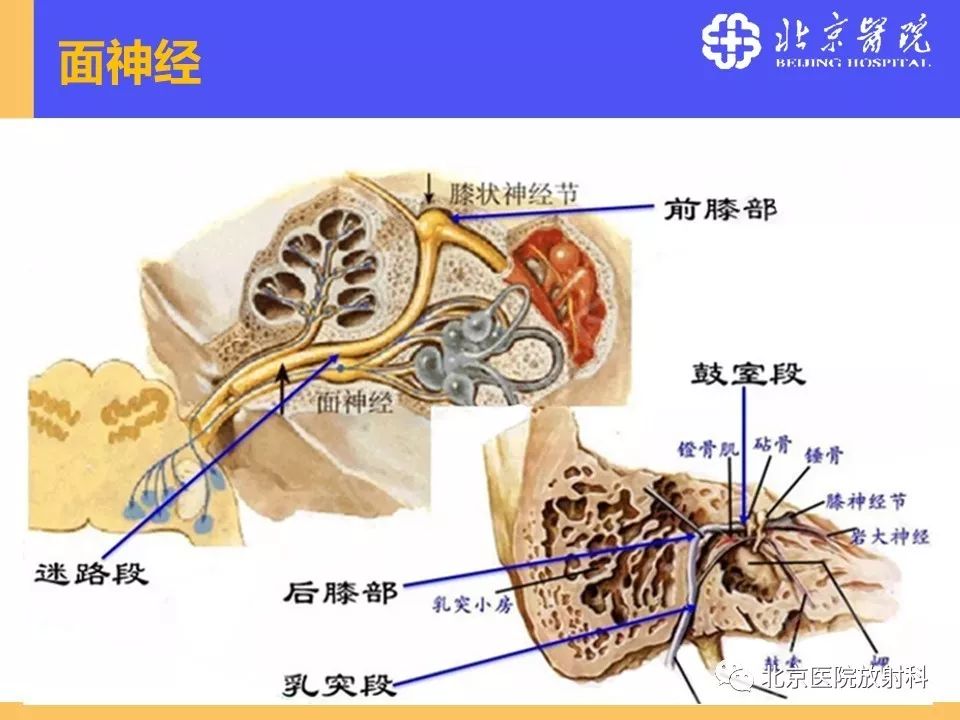 影像PPT - 【PPT】常见内耳畸形及后天获得性病变的影像表现-8