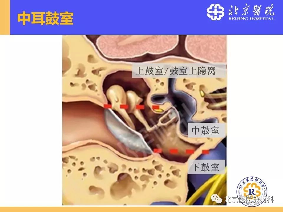 影像PPT - 【PPT】常见内耳畸形及后天获得性病变的影像表现-5