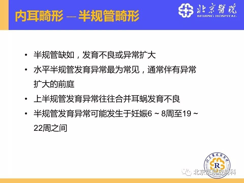 影像PPT - 【PPT】常见内耳畸形及后天获得性病变的影像表现-20