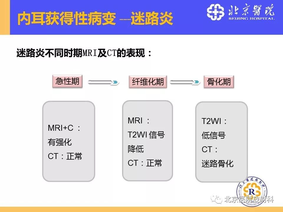 影像PPT - 【PPT】常见内耳畸形及后天获得性病变的影像表现-27