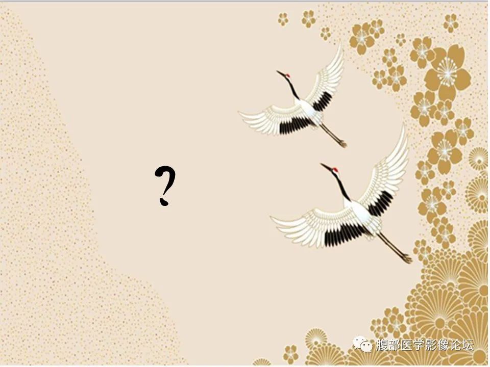 影像PPT - 【病例】胃印戒细胞癌1例CT及MR-18