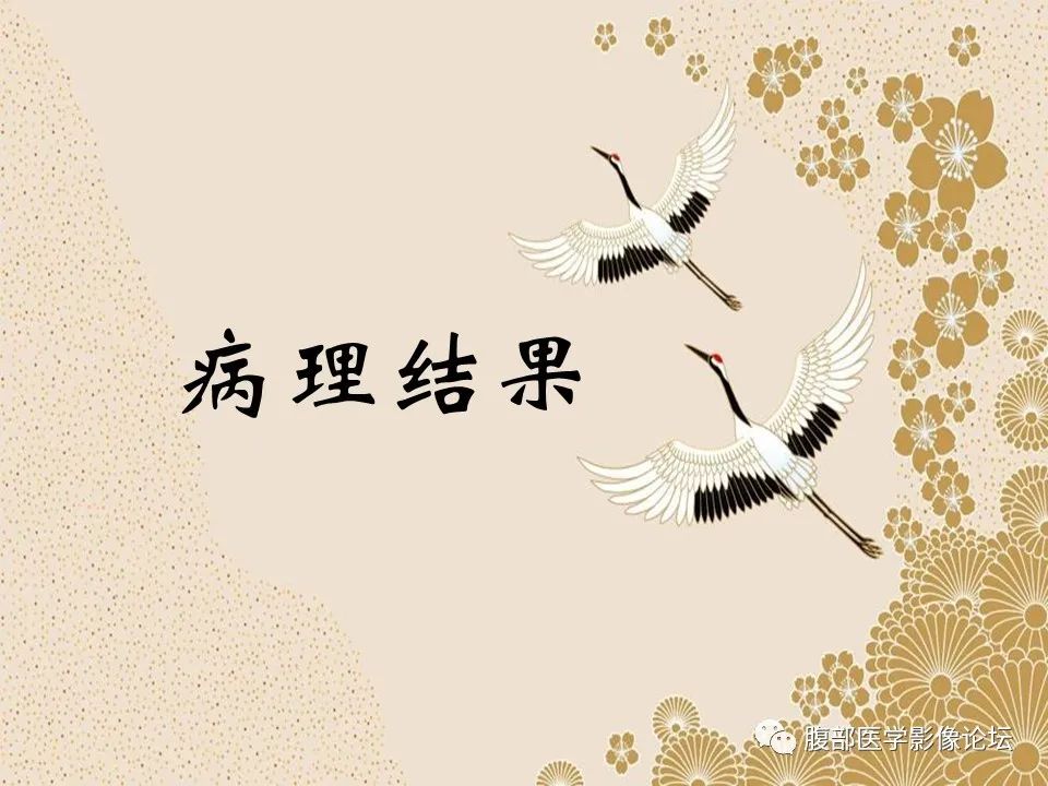 影像PPT - 【病例】胃印戒细胞癌1例CT及MR-19