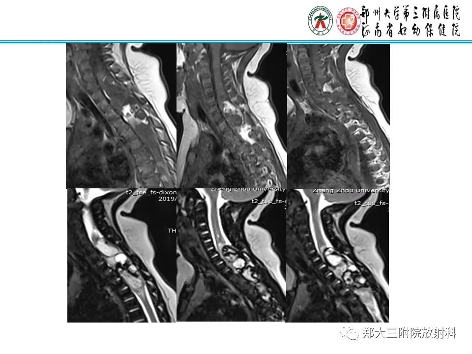 影像PPT - 【PPT】皮样囊肿与表皮样囊肿-2