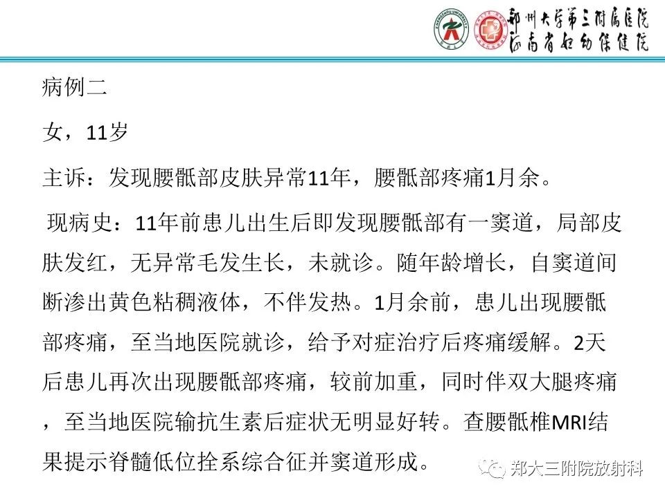 影像PPT - 【PPT】皮样囊肿与表皮样囊肿-7