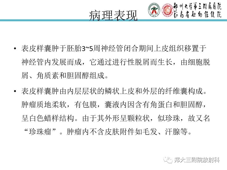 影像PPT - 【PPT】皮样囊肿与表皮样囊肿-23