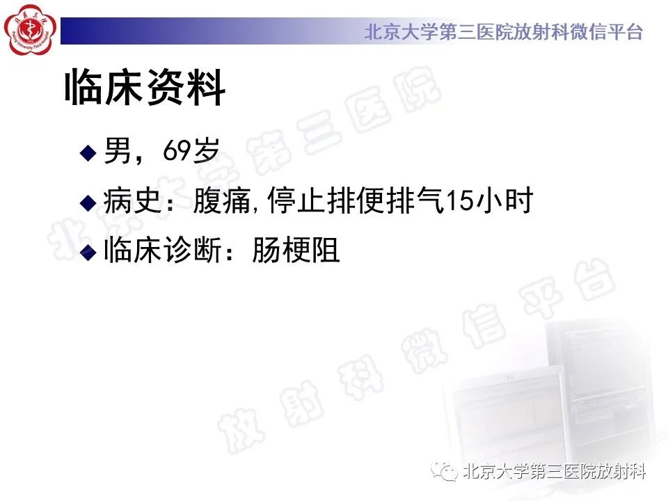 影像PPT - 【PPT】肠梗阻CT诊断注意事项-6