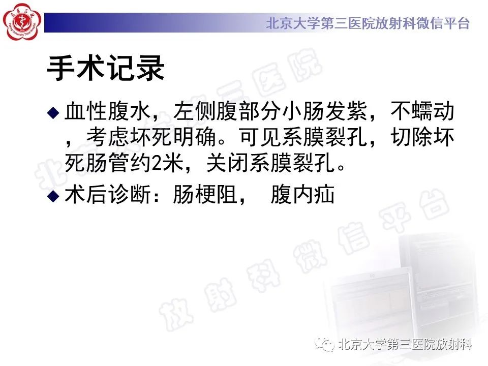 影像PPT - 【PPT】肠梗阻CT诊断注意事项-9