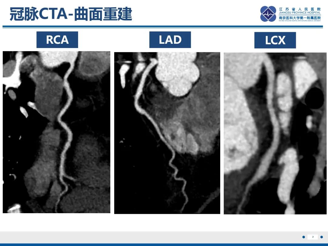 影像PPT - 【PPT】冠脉非阻塞型心肌梗死-3