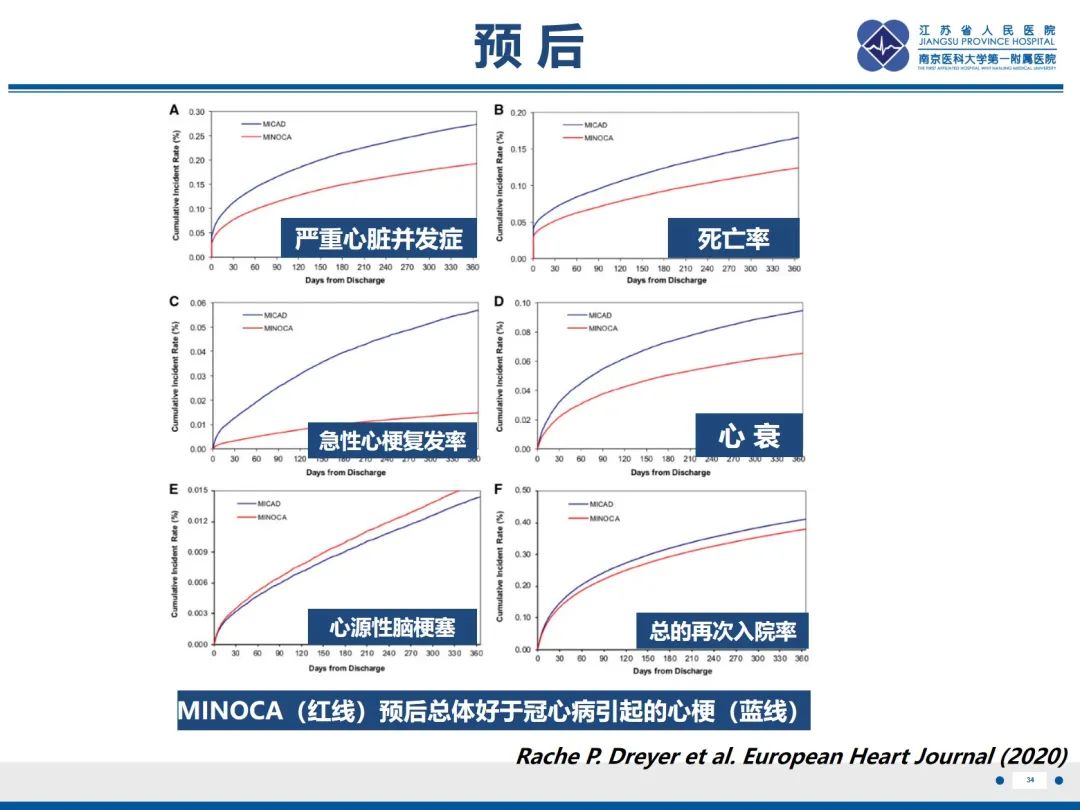 影像PPT - 【PPT】冠脉非阻塞型心肌梗死-35