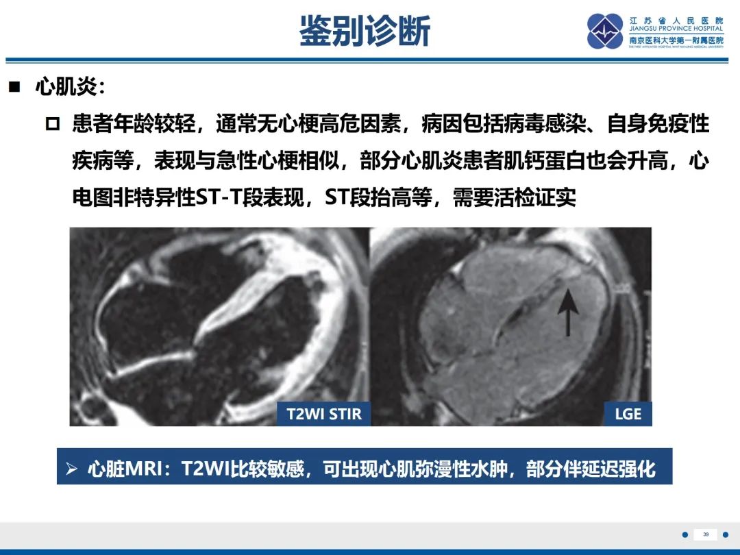 影像PPT - 【PPT】冠脉非阻塞型心肌梗死-40