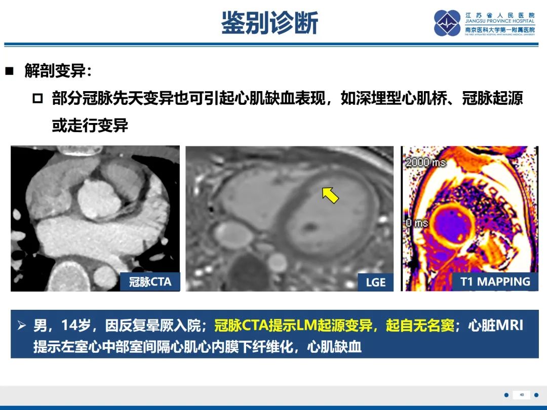 影像PPT - 【PPT】冠脉非阻塞型心肌梗死-41