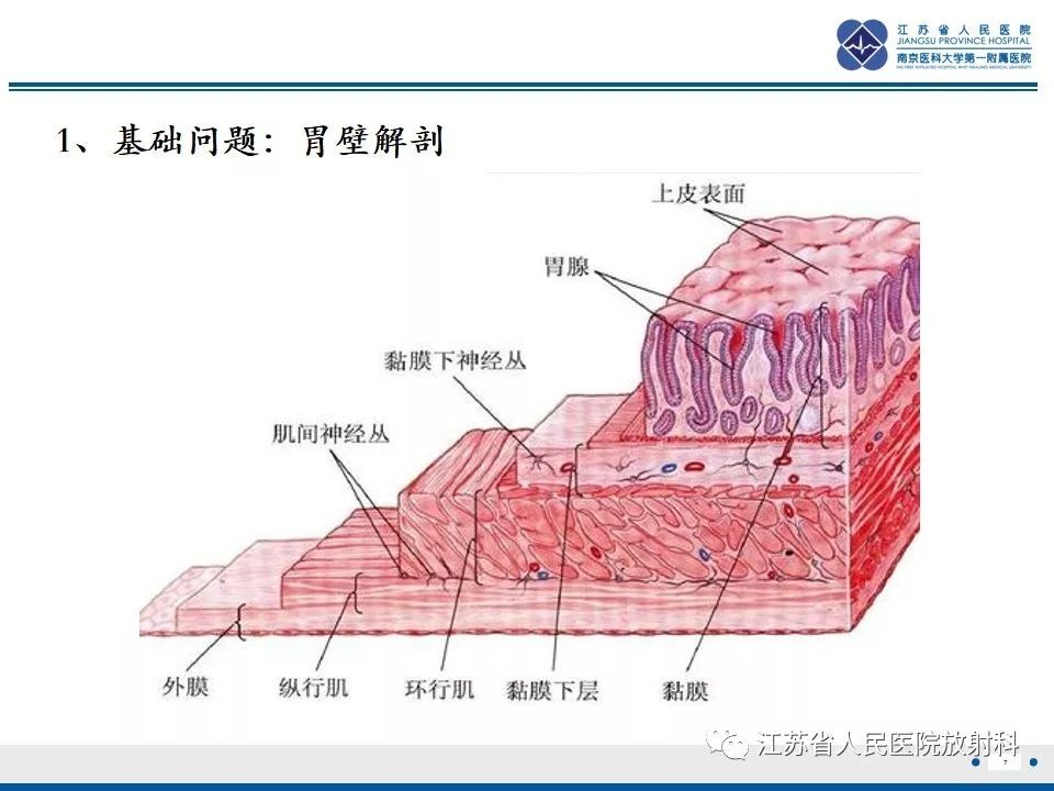 影像PPT - 【PPT】异位胰腺-8