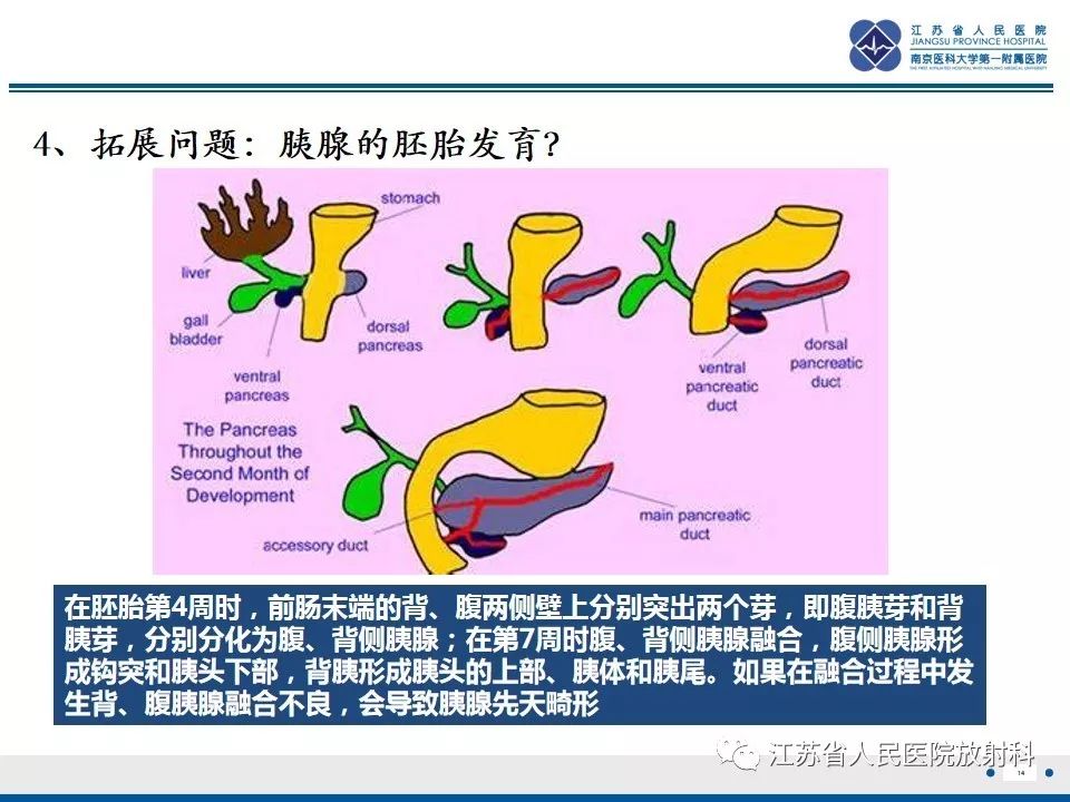 影像PPT - 【PPT】异位胰腺-15