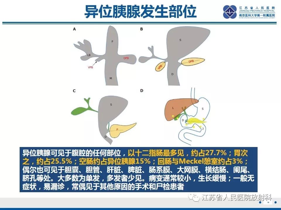 影像PPT - 【PPT】异位胰腺-19
