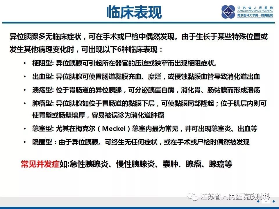影像PPT - 【PPT】异位胰腺-28