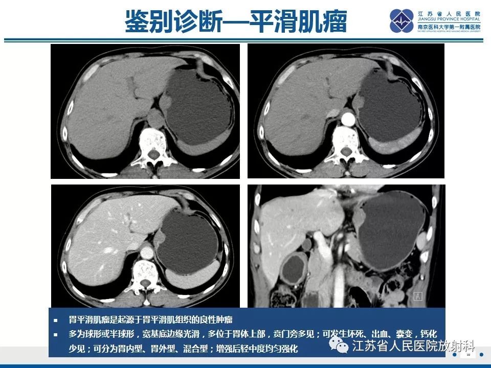 影像PPT - 【PPT】异位胰腺-31