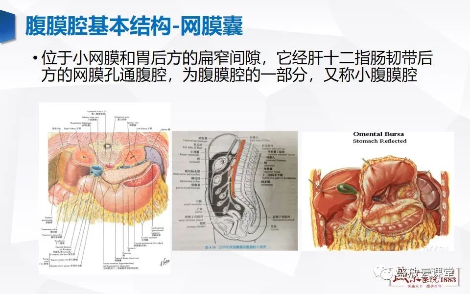 影像PPT - 【PPT】先天性腹内疝的影像诊断思路-6