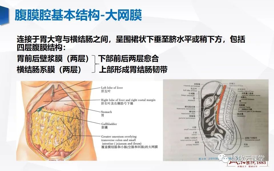 影像PPT - 【PPT】先天性腹内疝的影像诊断思路-4