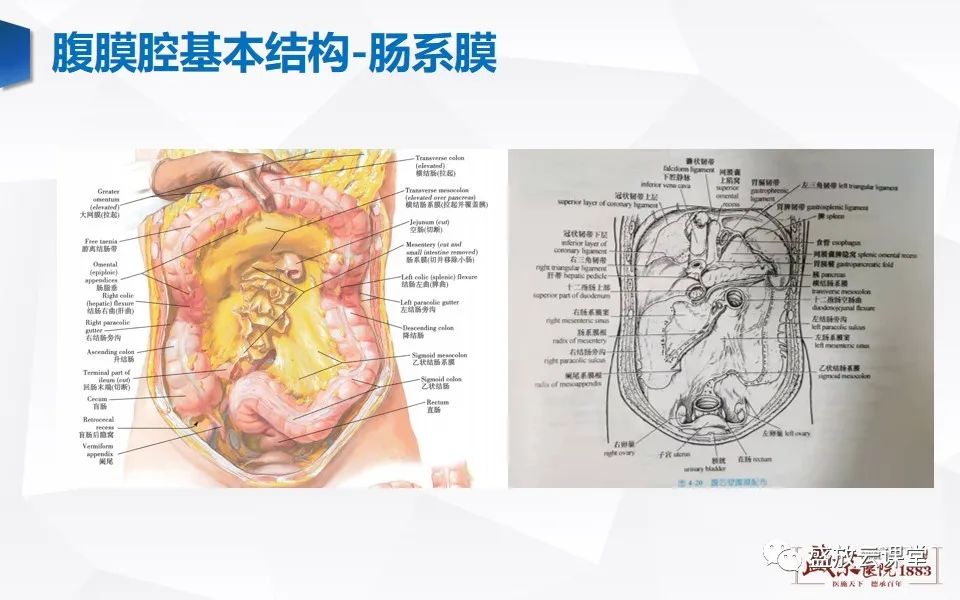 影像PPT - 【PPT】先天性腹内疝的影像诊断思路-9